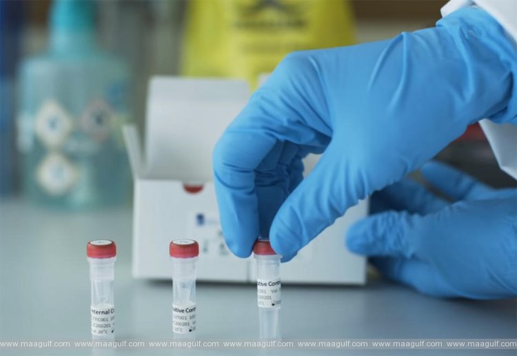 1 ఏ.పీలో కరోనా కేసుల వివరాలు