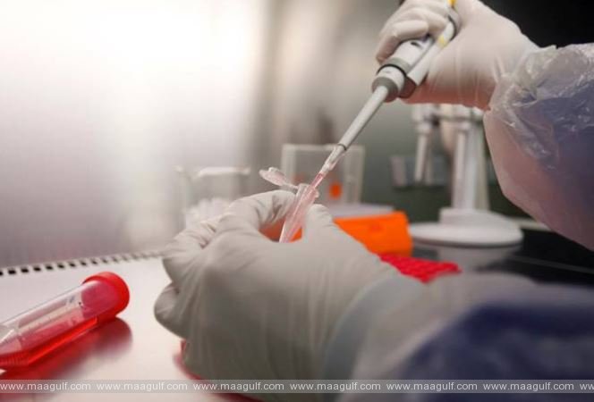 ఏపీలో కరోనా కేసుల వివరాలు