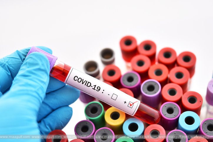 ఏపీలో కరోనా కేసుల వివరాలు