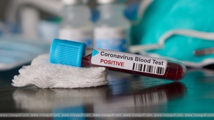 తెలంగాణలో కరోనా కేసుల వివరాలు