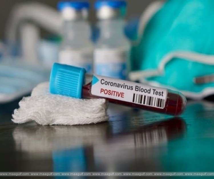 ఏపీలో కరోనా కేసుల వివరాలు