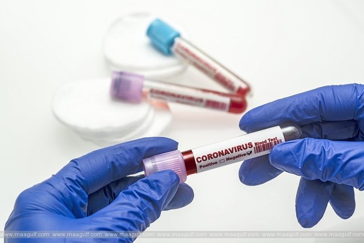 తెలంగాణలో కరోనా కేసుల వివరాలు