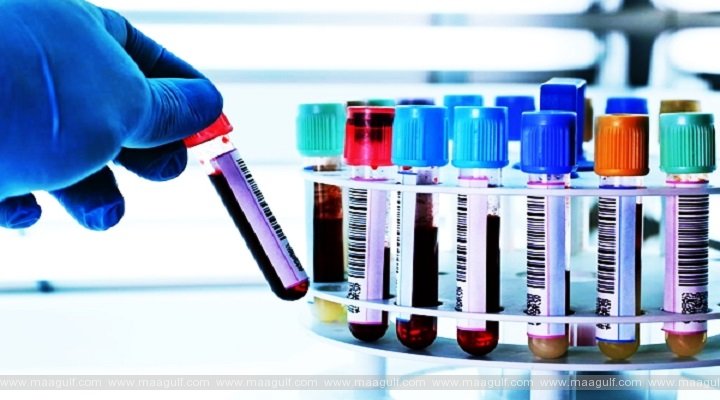 ఏపీలో కరోనా అప్డేట్