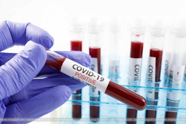 తెలంగాణ కరోనా అప్డేట్