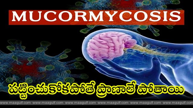 ‘బ్లాక్‌ ఫంగస్‌’: పట్టించుకోకపోతే ప్రాణాలే పోతాయి..మార్గదర్శకాలు జారీ చేసిన ఐసీఎంఆర్‌