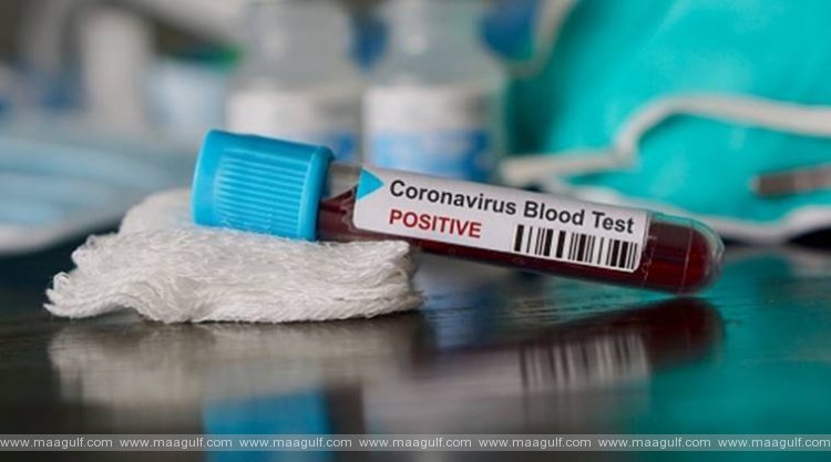 ఏపీలో కరోనా కేసుల వివరాలు