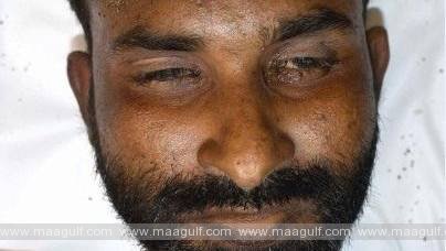 ఆ మృతదేహం ఎవరిది..? ప్రవాసీయుల సాయం కోరిన పోలీసులు