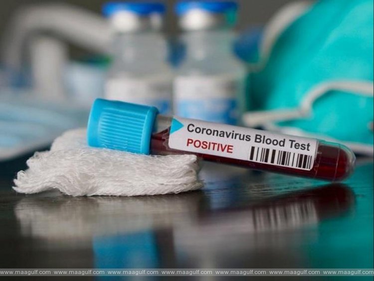 ఏపీలో కరోనా కేసుల వివరాలు