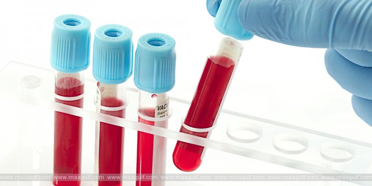 తెలంగాణ కరోనా అప్డేట్