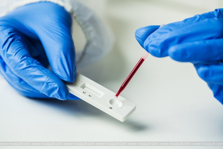 ఏపీ కరోనా అప్డేట్