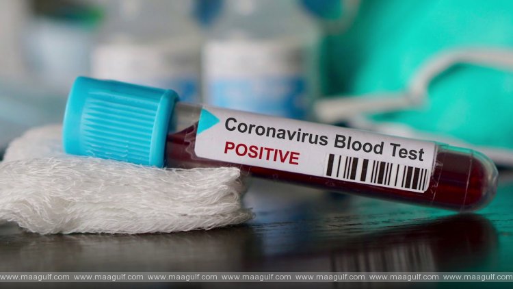 ఏపీ కరోనా అప్డేట్