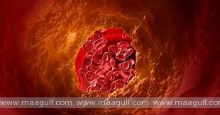 కొలెస్ట్రాల్  స్థాయిలను తగ్గించే సహజ మార్గాలు..