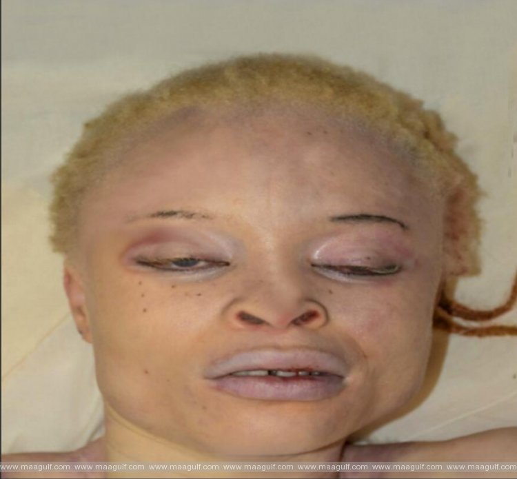 రోడ్డు ప్రమాదంలో మహిళ మృతి: ఆమెను గుర్తించేందుకు ప్రయత్నాలు