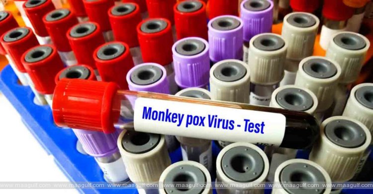 విజయవాడలో రెండేళ్ల చిన్నారిలో మంకీ పాక్స్ లక్షణాలు..