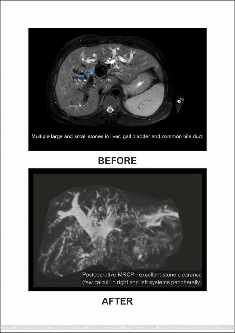 మెడికవర్ హాస్పిటల్స్ లో అరుదైన చికిత్స