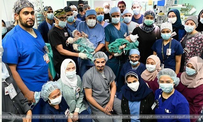 1 సౌదీలో కవలలను విజయవంతంగా వేరు చేసిన వైద్య బృందం