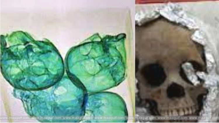 1 మెక్సికో విమానాశ్రయం: సూట్ కేసులో మనుషుల పుర్రెలు గుర్తింపు