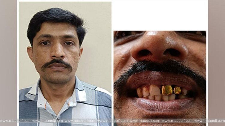 1 15 ఏళ్ల తర్వాత నిందితుడిని పట్టించిన బంగారు పళ్లు