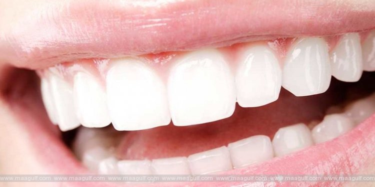 తెల్లగా మెరిసిపోయే దంతాల కోసం.!