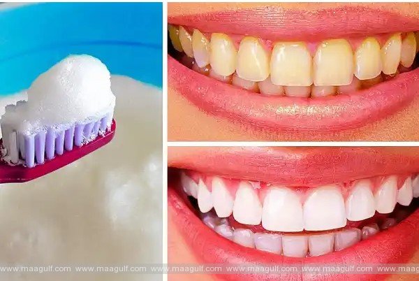 గార పట్టిన దంతాలు తెల్లగా ముత్యాల్లా మెరిసిపోవాలంటే.!