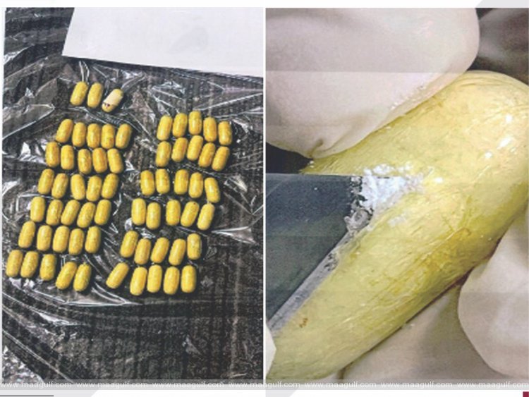 ప్రయాణికుడి కడుపులో దొరికి 80 నార్కోటిక్ క్యాప్సూల్స్‌