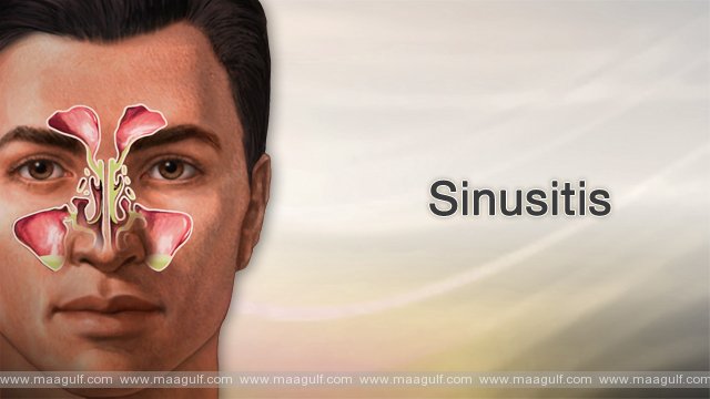 సైనసైటిస్ వున్న వాళ్లు ఈ డైట్ తప్పక పాఠించాల్సిందే.!