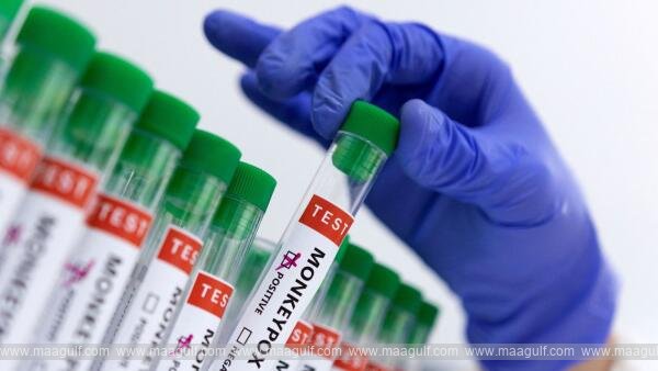 1 Mpox గ్లోబల్ హెల్త్ ఎమర్జెన్సీ.. లక్షణాలు, నివారణ మార్గాలు..!