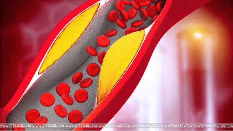 వాముతో కొలెస్ట్రాల్ కరిగించేసుకోండిలా.!