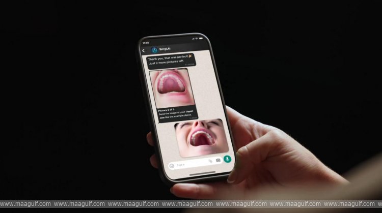 20 Aster Clinics Introduce Smyl AI