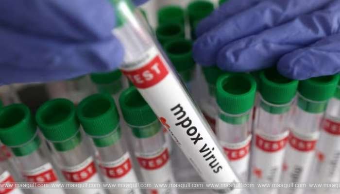 Oman\'s Health Ministry issues advisory for Mpox