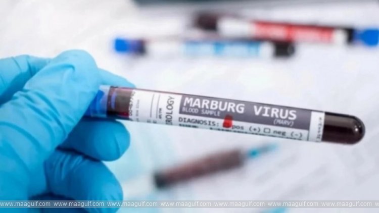 మార్బర్గ్ వైరస్ వ్యాప్తి పై సౌదీ ఎంబసీ హెచ్చరిక..!!