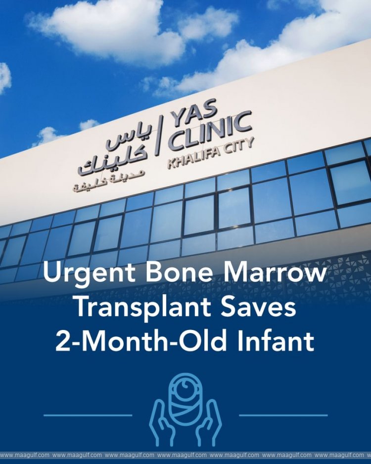 Yas Clinic performs lifesaving urgent bone marrow transplant for 2-month-old infant